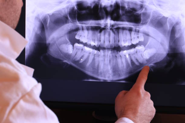 Best Emergency Dental Care for Broken or Chipped Teeth in Myrtle Point, OR