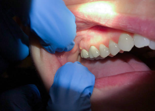 Best Pediatric Emergency Dentist in Myrtle Point, OR
