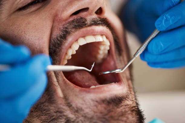 Best Emergency TMJ Treatment in Myrtle Point, OR